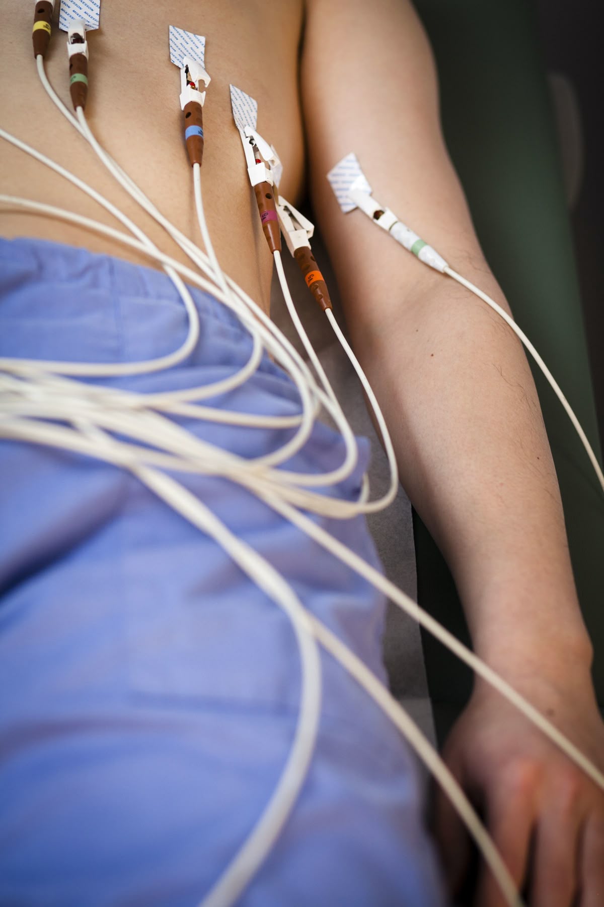 Electrocardiogram (ECG)